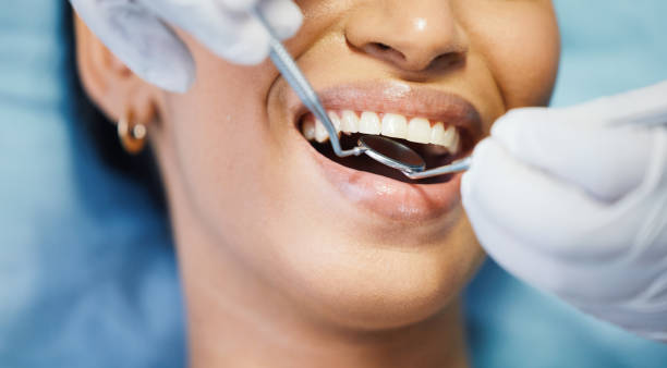 Best Emergency Wisdom Tooth Extraction in Groton, SD